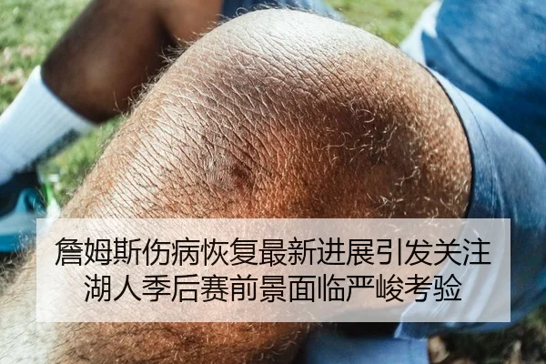 詹姆斯伤病恢复最新进展引发关注 湖人季后赛前景面临严峻考验